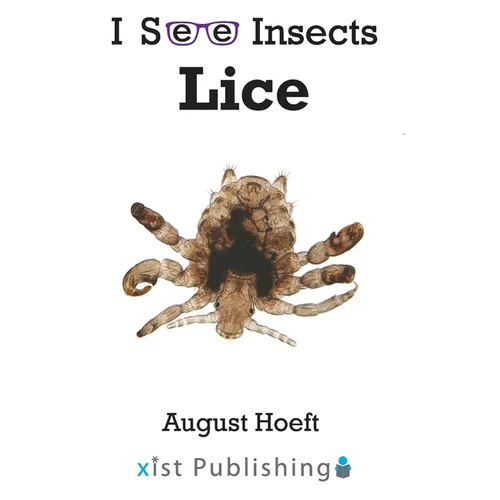 Lice