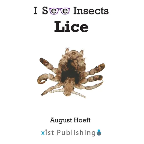 Lice