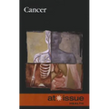 Cancer