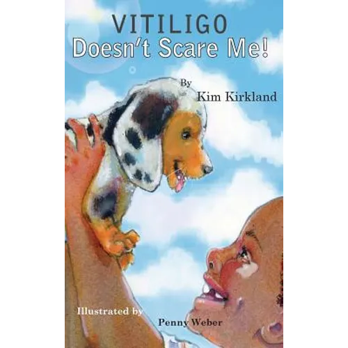 Vitiligo Doesn't Scare Me